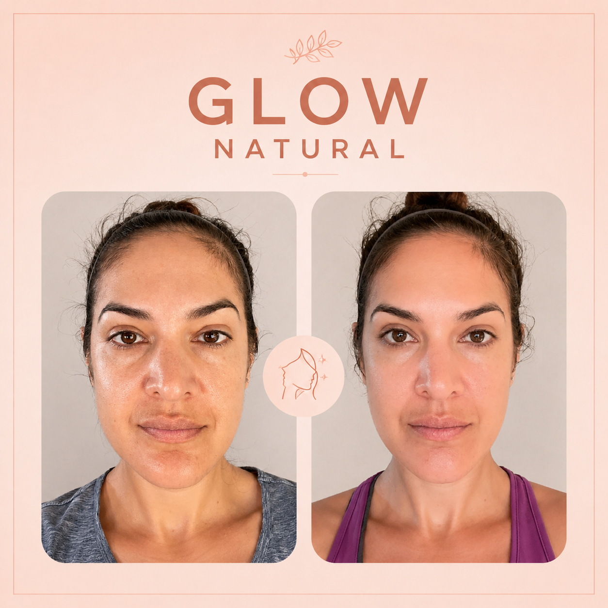 Aura Lift® - Desinflama y define tu rostro